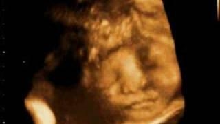 Baby Jury Tirol video 3 (yawn)