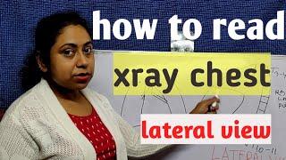 How to read chest xray lateral view|