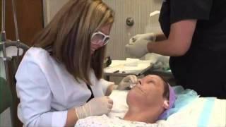 Fraxel® Laser Skin Resurfacing Newport Beach CA