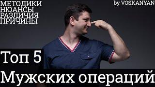 Мужские операции о которых ты не знал! Носовая перегородка! Пластическая хирургия для мужчин!