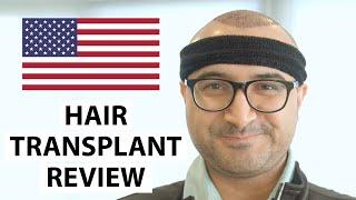 HELLO USA! Arslan's Hair Transplant Experience at AEK Hair Clinic