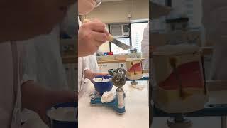 #mounting #articulator #dentatus # lower #mandibular #completedenture