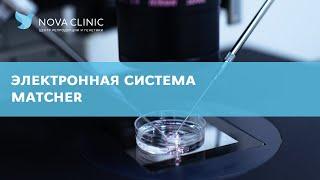 Система Matcher в Нова Клиник