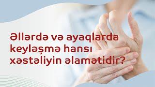 Əllərdə və ayaqlarda keyləşmə hansı xəstəliyin əlamətidir?