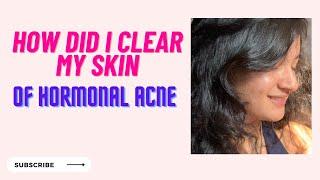 How Did I Clear My Skin Of ACNE! Complete Skincare Routine