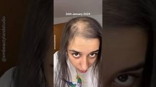 30 Days Hair Growth Challenge  | Hair Growth Tips  #shorts #youtubeshorts Smbeautylandstudio