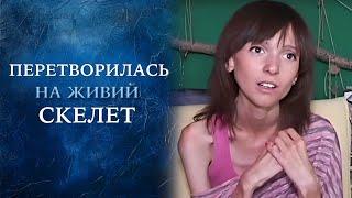 ПОЧЕМУ Эрика превратилась в живой СКЕЛЕТ?! Смотрите выпуск на "Говорить Україна". Архів