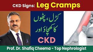 CKD Sign N0 3 : Leg Cramps, Causes & Treatment #ckd #cramps #kidneys #patients #kidneyfailure