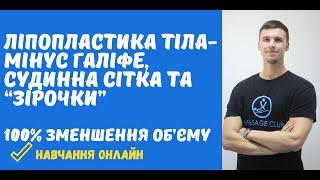 Антицелюлітний масаж, який гарантовано прибере галіфе, судинну сітку та "зірочки" на ногах.