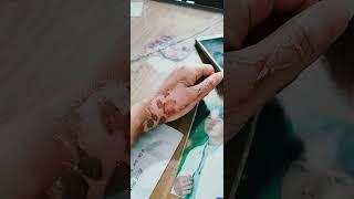 perubahan bekas luka bakar tersiram air mendidih   25okt - 7nov