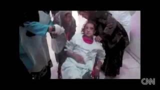 Afghan girl found tortured