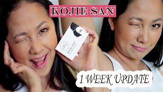 Kojie San Skin Whitening Soap Review | 1 week Update | Beautymagz