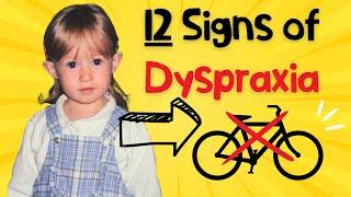 Could you actually have Dyspraxia (DCD)?