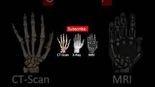 CT scan,x-ray,MRI, Difference #music #medical #art #artfact #travel #love #edm #radiation #fact