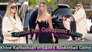 Khloe Kardashian exposes her collapsed nose at Nephew Saint’s game in Los Angeles ! Khole Kardashian