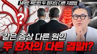 같은 증상 다른 원인 두 환자의 다른 결말!? | 척추 MRI 소견 | 참포도나무병원 이동엽 원장