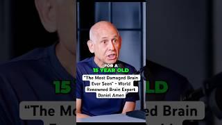 “The Most Damaged Brain Ever Seen” - World Renowned Brain Expert Dr Daniel Amen