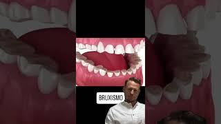 Бруксизм #стоматолог #dentist #бизнес