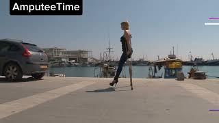 amputee woman crutching with underarm crutches