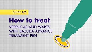 How to treat verruca's and warts with Bazuka Advance Treatment Pen