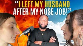She 'DIVORCED' Her Husband After Getting a "NOSE JOB"...