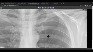 Commonly Missed X rays FREE WEBINAR!