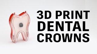 How to 3D print PFM dental crowns // Glidewell Laboratories