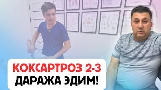 КОКСАРТРОЗ 2-3 ДАРАЖА: БЕМОРНИНГ ОЛГАН НАТИЖАЛАРИ ВА ТАВСИЯЛАРИ!