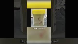Worm lives in the human brain  #shorts #discovery #science #mystery