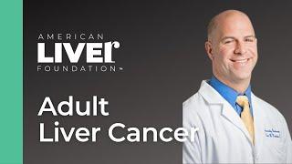 Ask the Experts: Liver Cancer: Symptoms, Diagnosis and Treatment