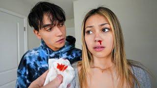 My Girlfriend gets a BLOODY NOSE, What Happens is Shocking