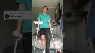 LONG LEG CAST #legcast #trending
