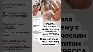 Решила проблему с аллергическим Дерматитом #siberianwellness #аллергическийдерматит #стресс #фармаси