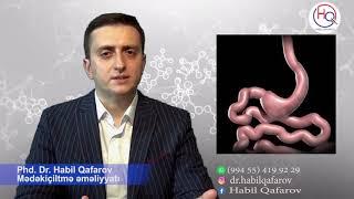 Mədəkiçiltmə Əməliyyatından sonra qidalanma | Pəhriz | PhD.Dr. Bariatrik Cərrah Habil Qafarov