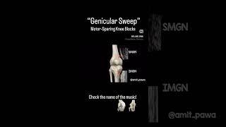 Genicular Sweep