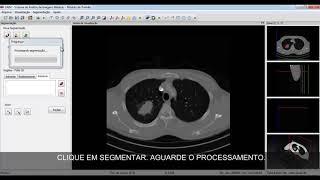 SAIM - CAD/CADx System