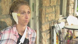 Kansas City Costco hit-and-run victim speaks out