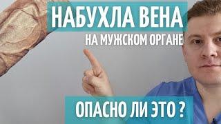 Вены на половом органе | Плотные и болят | Что делать ?