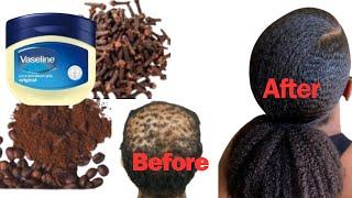 Wow! It Works Just Mix Vaseline, Cloves and Coffee & Grow Excessively Long and Thick Hair