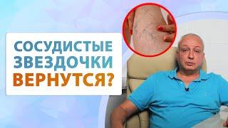 Как удалить сосудистые звездочки