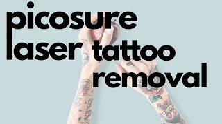 TATTOO REMOVAL AT SIGNATURE MED SPA