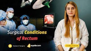 Surgical Conditions of Rectum | General Surgery Video Lectures | V-Learning | sqadia.com