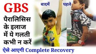 gbs physiotherapy treatment || paralysis exercise for hand and leg || guillain barre syndrome.