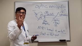 Optic Neuropathy Localization