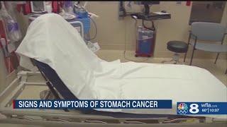 GI experts warn of stomach cancer symptoms and preventative measures you can take