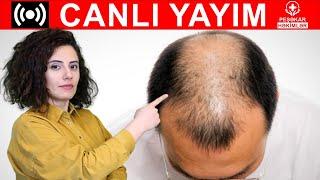 SAÇ TÖKÜLMƏSİ, BƏRPASI VƏ ƏKİMİ - CANLI YAYIM - PEŞƏKAR HƏKİMLƏR