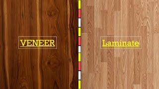 Difference Between Veneer & Laminate || विनियरस और लैमिनेट ! Veneer vs Laminate ! Laminate vs veneer