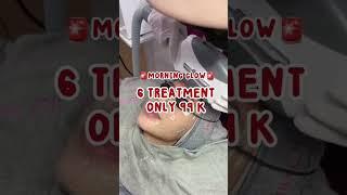 99ribu bisa treatment di klinik! #nadfaskin #nadifaclinic #haha