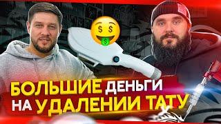 Миллионы на удалении тату