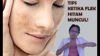 Kebiasaan Kecil Yang Terbukti Menghilangkan Melasma Flek Hitam by Dr. Grand